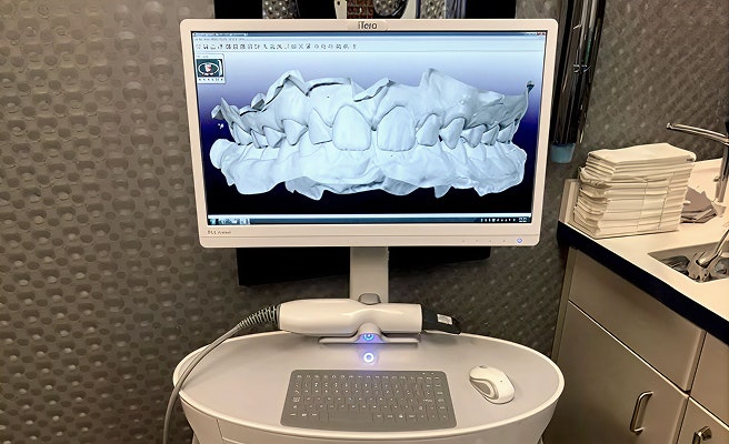iTero scanner