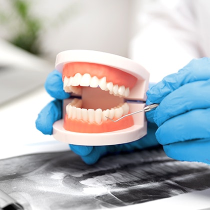 Model of complete dentures