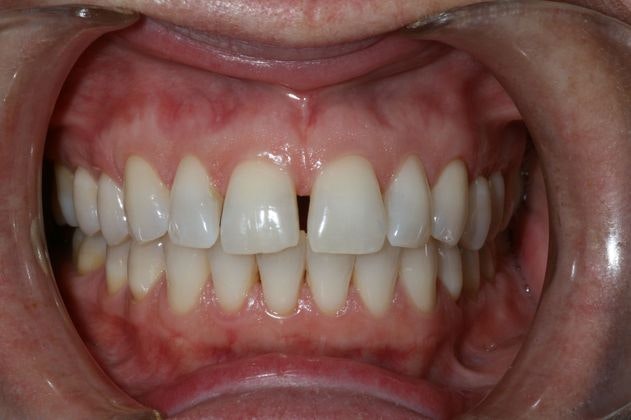 Dr. Victor Siegel's patient before treatment