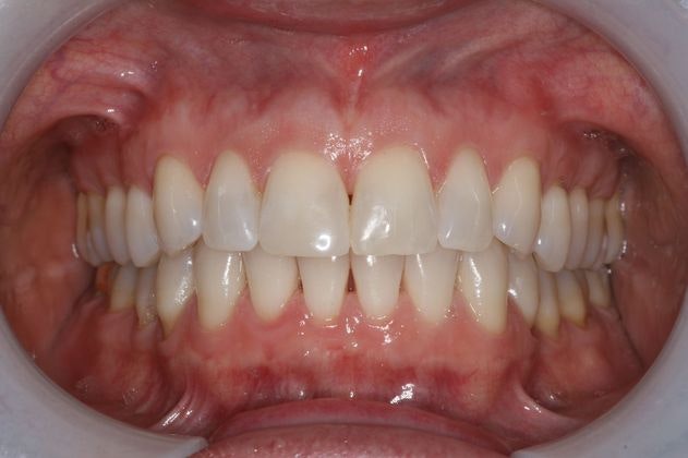 Dr. Victor Siegel's after treatment