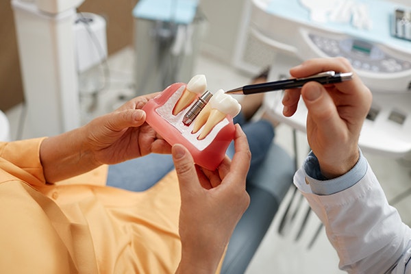 doctor showing a model of dental implants