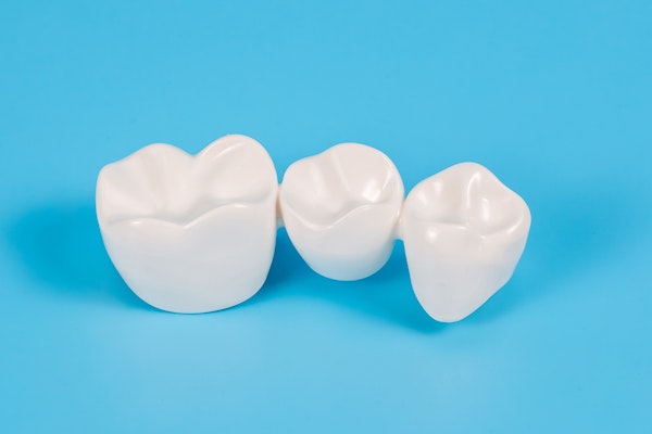 A traditional dental bridge