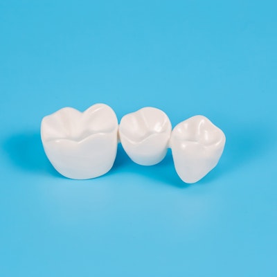 A traditional dental bridge