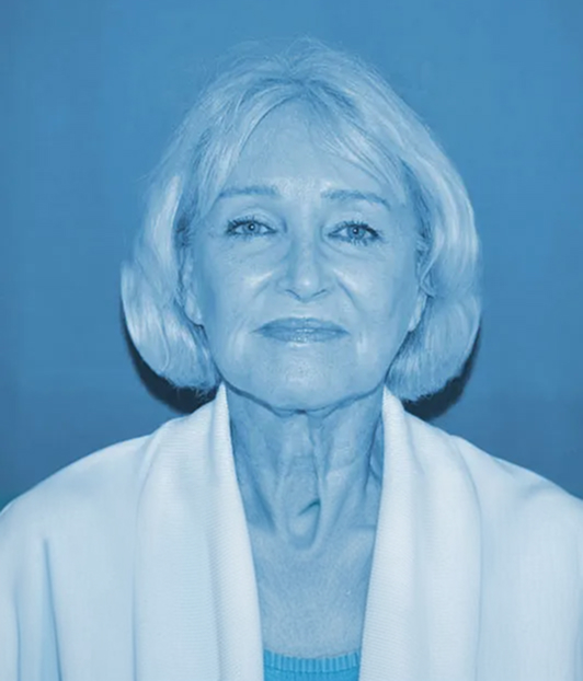 Patient before facelift