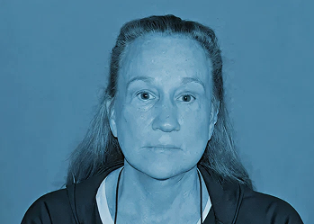 A woman after a deep plane facelift