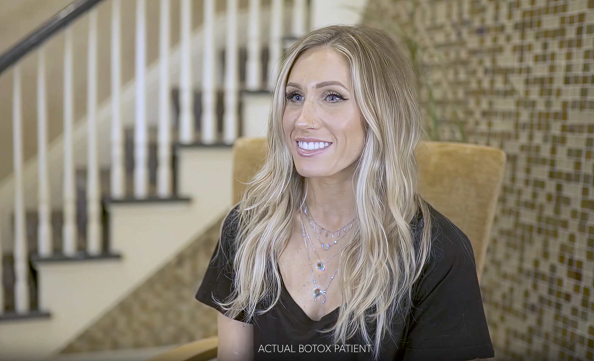 Smiling Botox patient