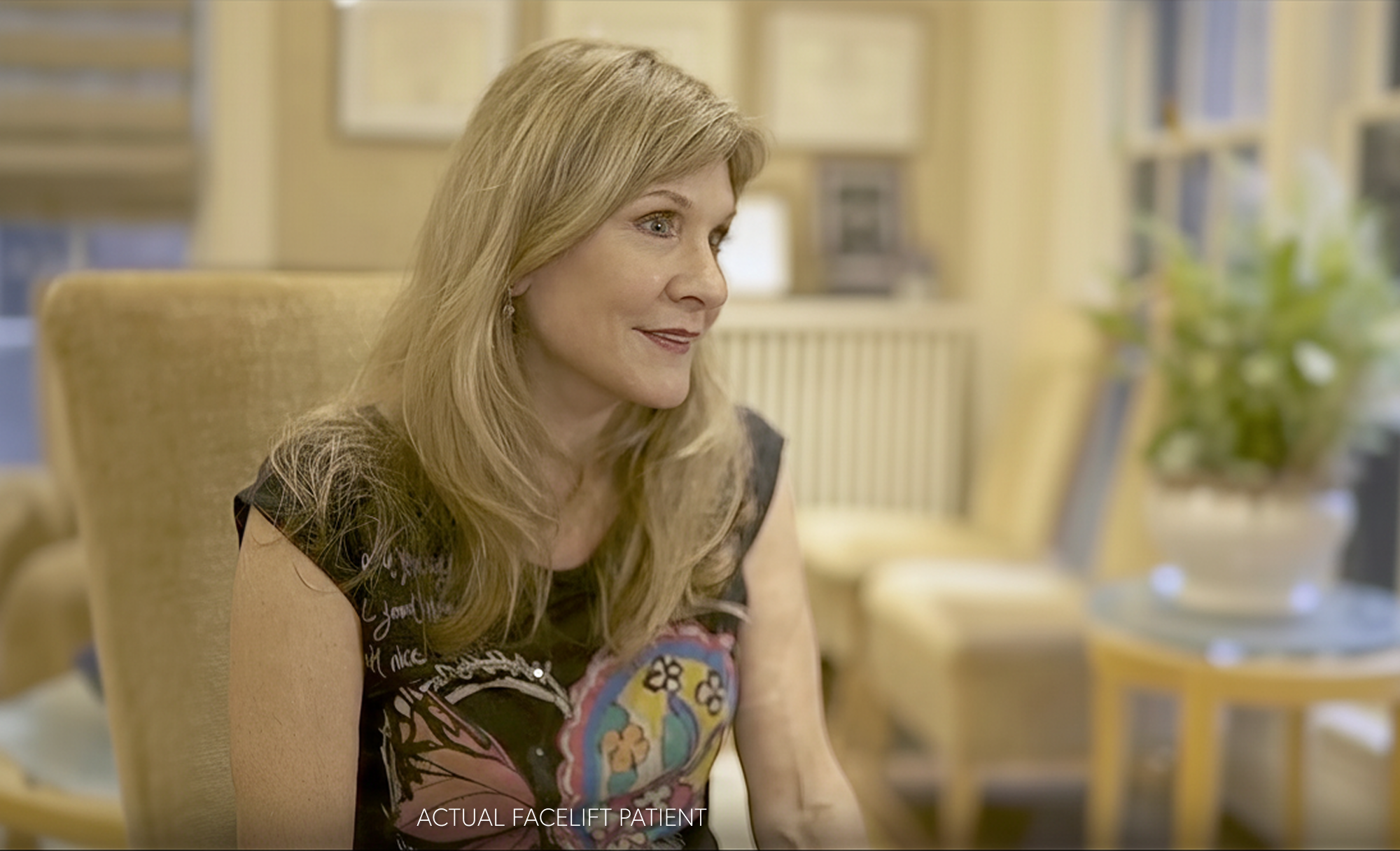 Real patient facelift results