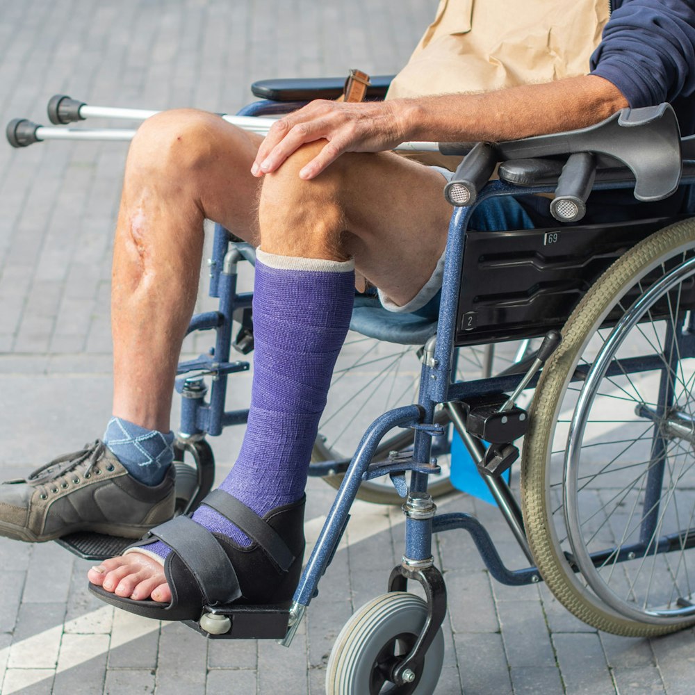 Man's legs in a wheelchair with a cast on one leg