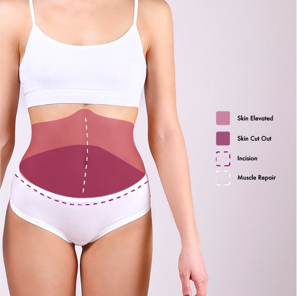 Diagram showing different treatment areas