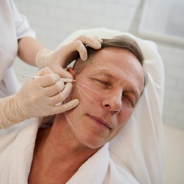 Surgeon marking facelift area