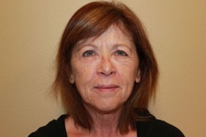 Dr. Stephen P. Hardy's Patient Before Facelift