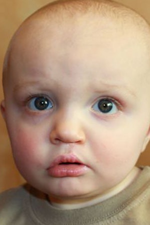 After cleft palate surgery