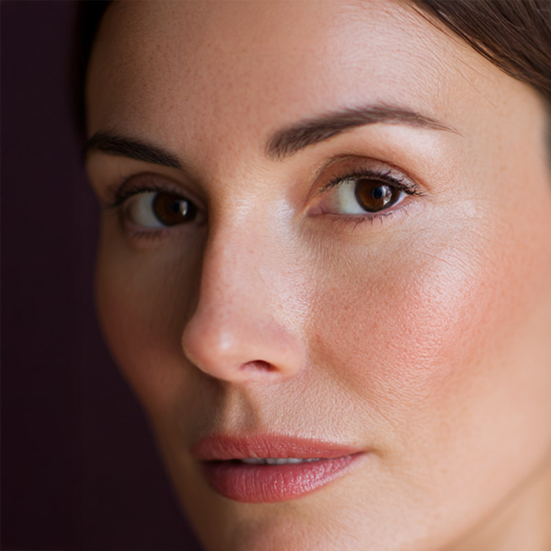 Beautiful woman after eyelid surgery