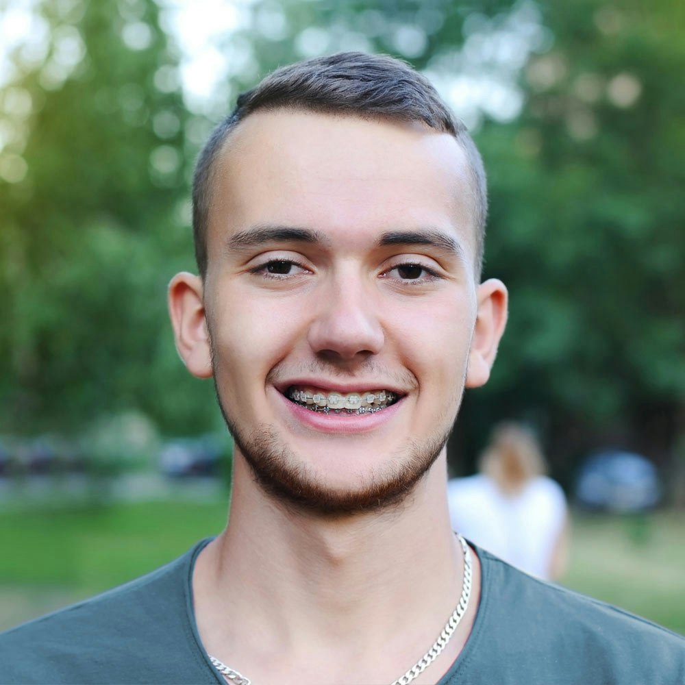 Smiling young man with Six Month Smiles