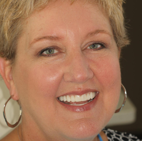 Smiling woman with short blonde hair and hoop earrings, wearing a patterned top