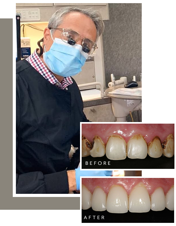 Dr. Nick wearing a mask and loupes in a dental operatory, shown alongside before-and-after photos of a patient’s severely decayed front teeth restored to a healthy, natural appearance