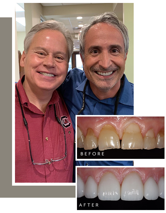 Dr. Nick smiling with his patient Dennis, shown alongside before-and-after photos of restored front teeth