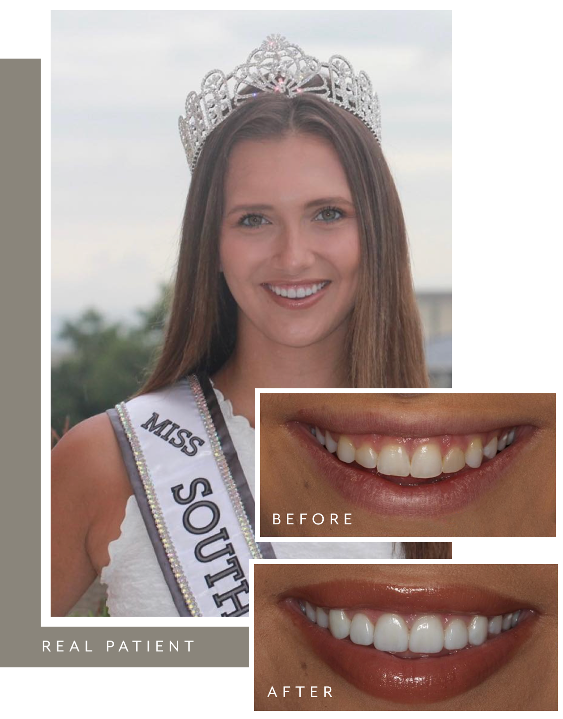 Patient before and after collage