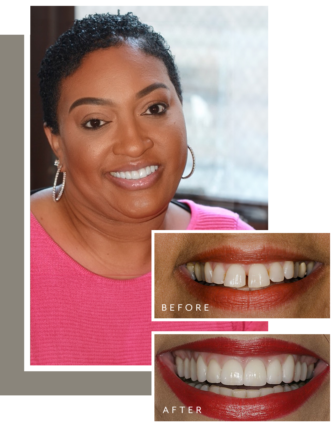 Before & after collage