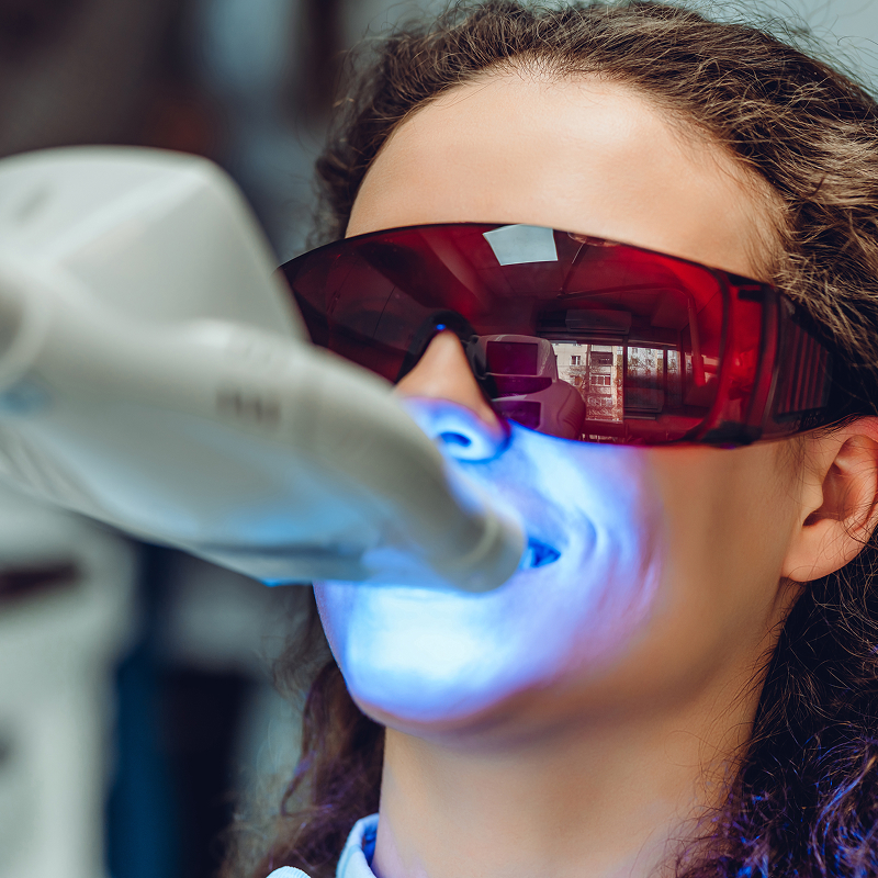 woman getting her teeth professionally whitened