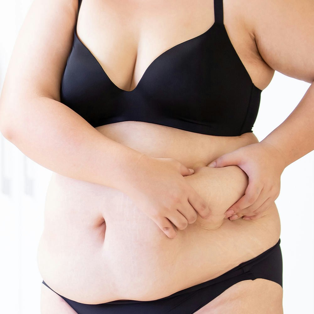 Large woman wearing black underwear and holding stomach in the mirror