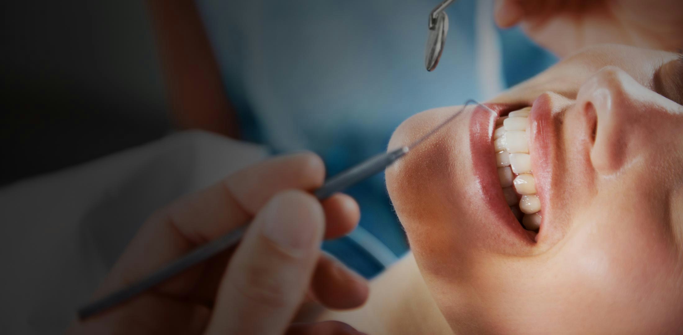 closeup of patient mouth