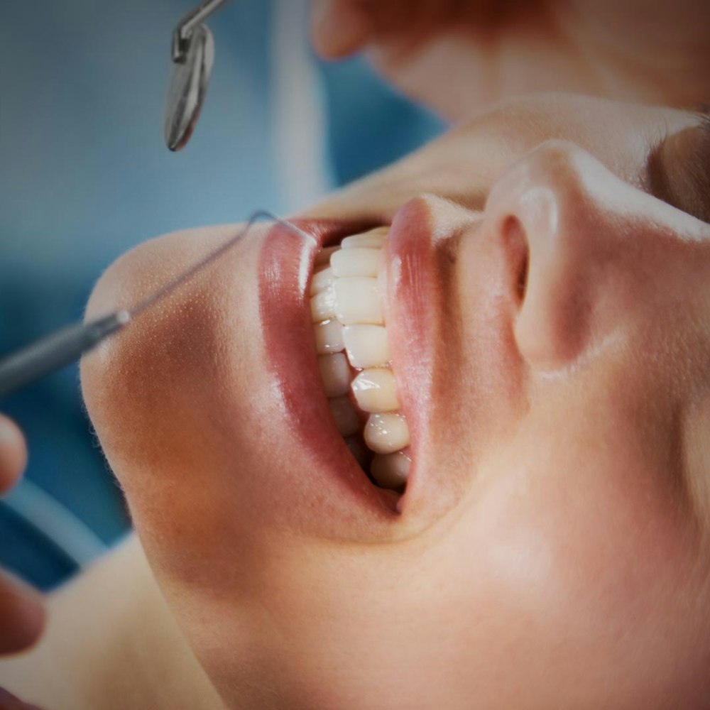 closeup of patient mouth