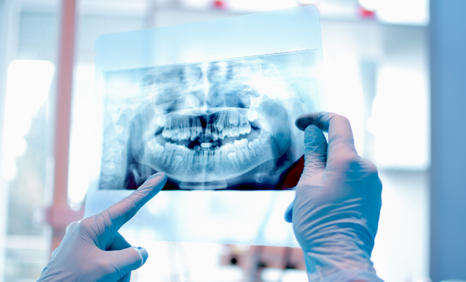 Dental x-ray