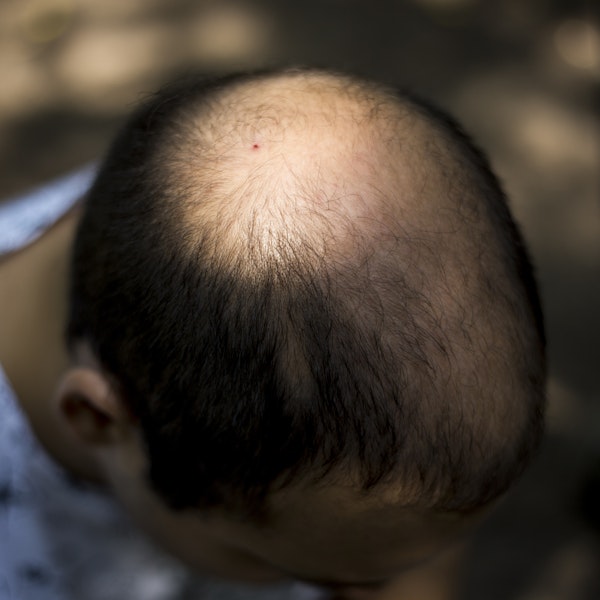 Image of a mans head