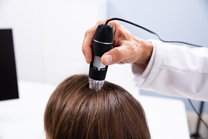 Doctor using a laser to treat hair loss
