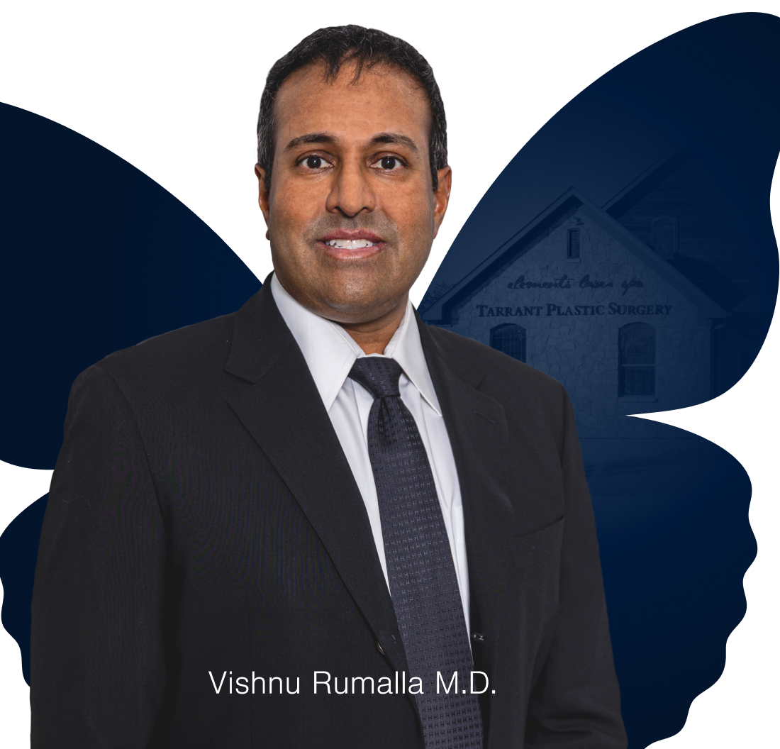Vishnu Rumalla M.D.