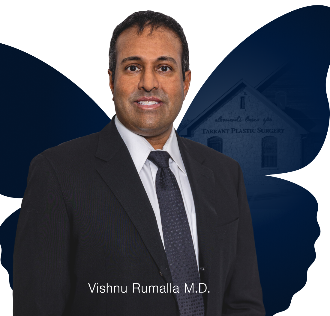 Vishnu Rumalla M.D.