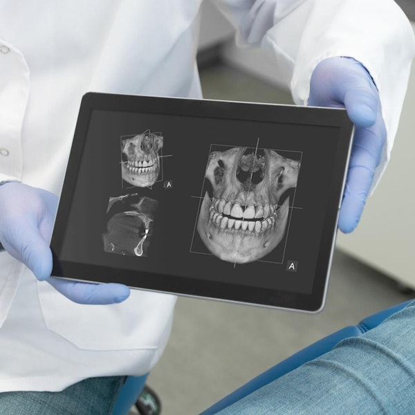 Patient's dental x-rays displayed on iPad
