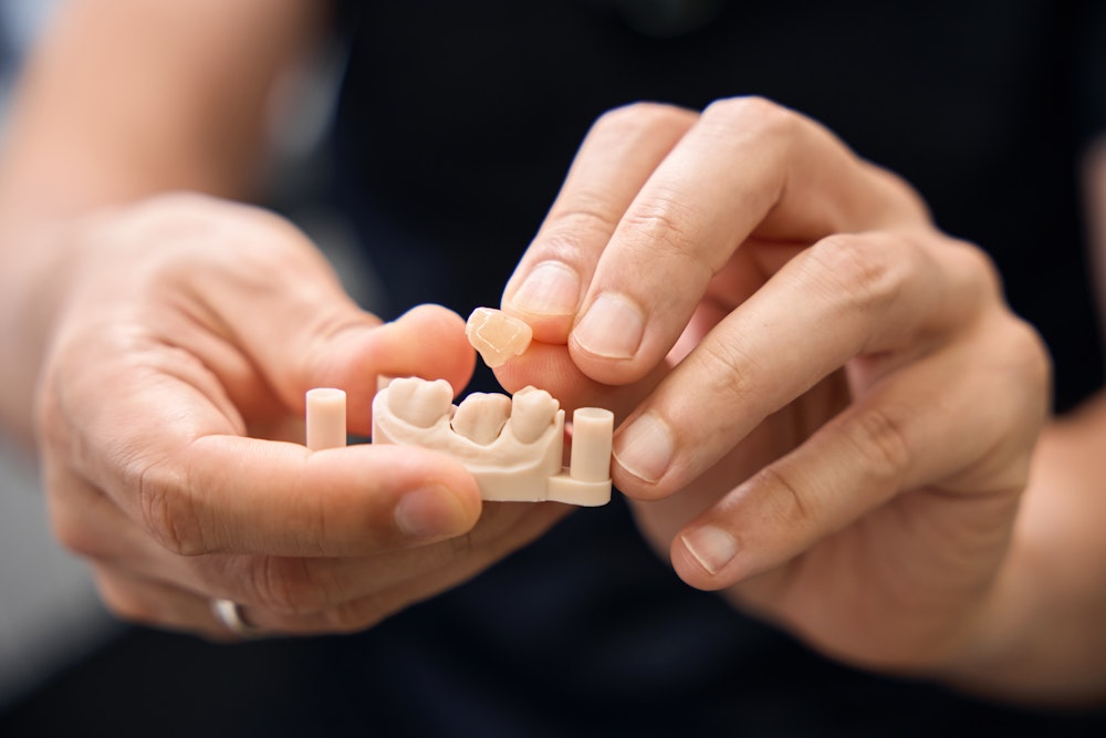 Doctor placing a dental crown example on a tooth model
