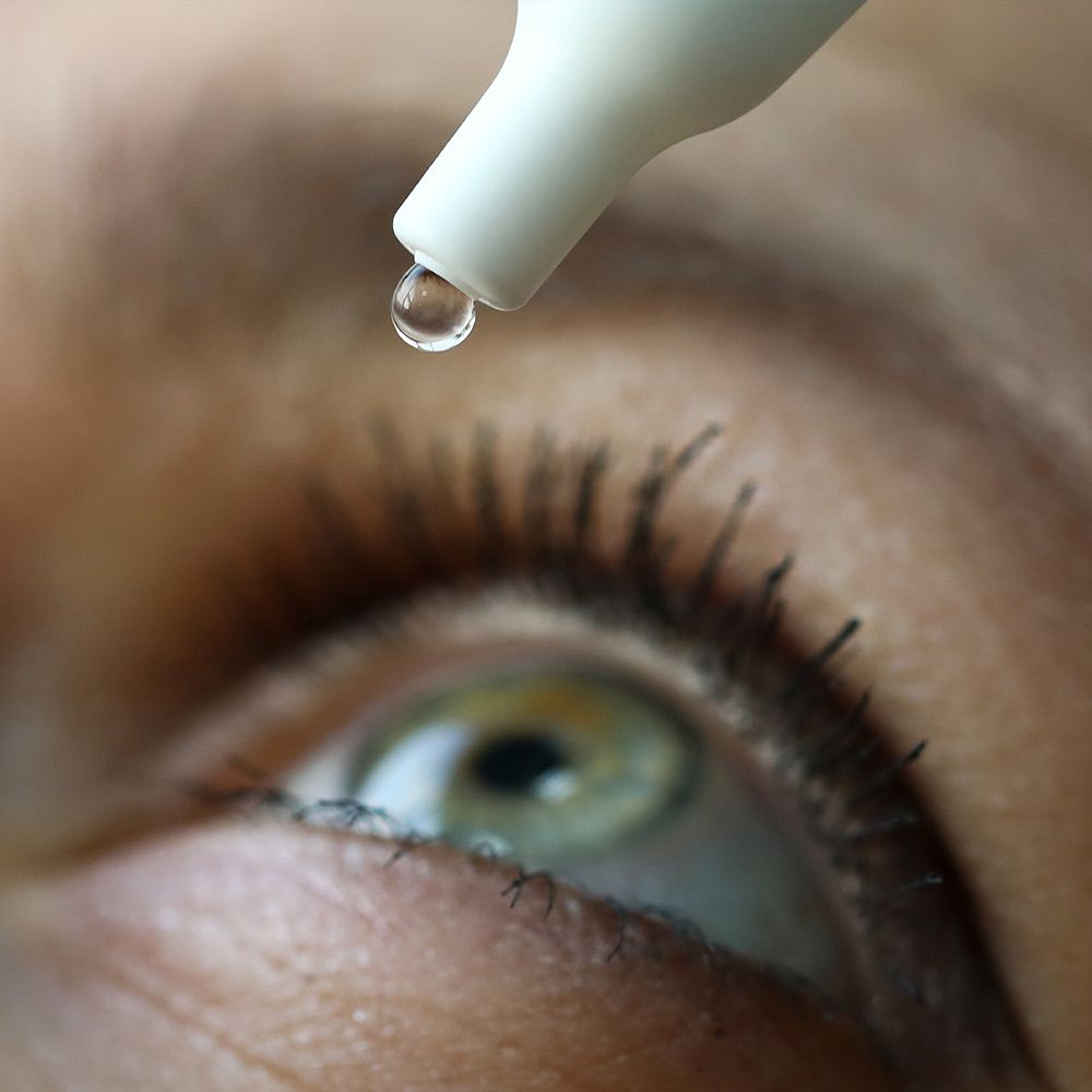 eye drops going in a woman's eye