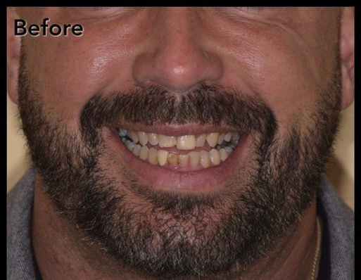 Dental Associates or New England patient before dental treatments