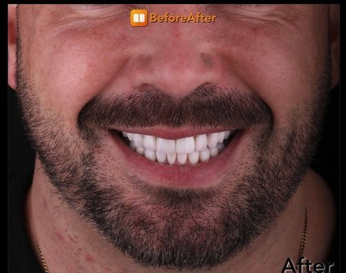 Dental Associates or New England patient after dental treatments