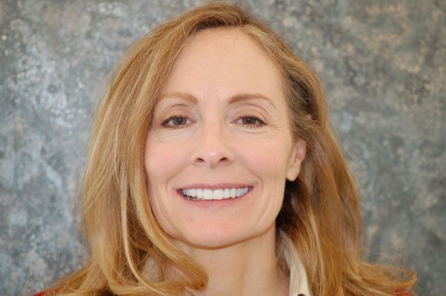 A patient after getting dental crowns