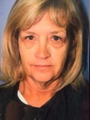 Before facelift in Scottsdale