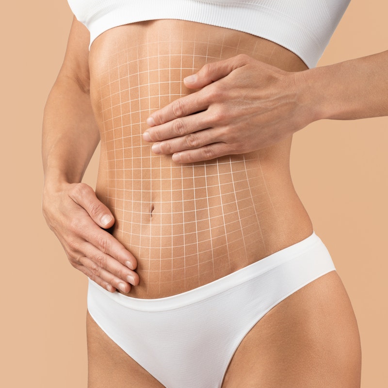 Tight, lean torso after Renuvion treatment