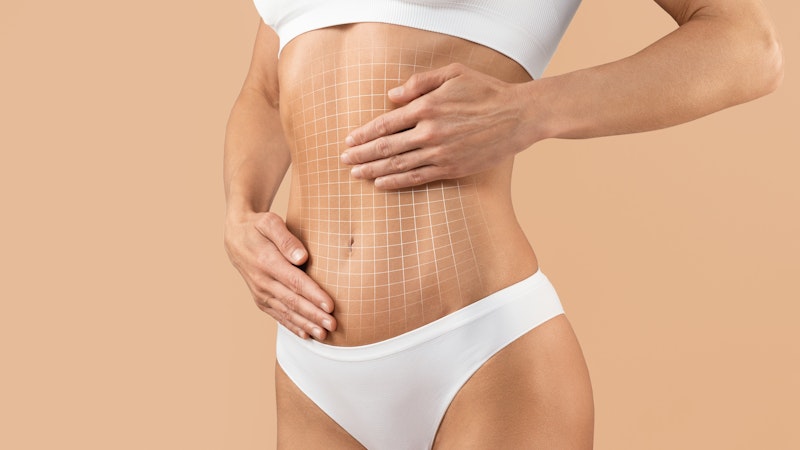Tight, lean torso after Renuvion treatment
