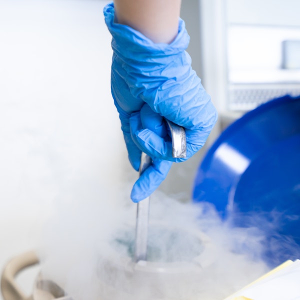 Close-up of a medical technician's hand with frozen storage system