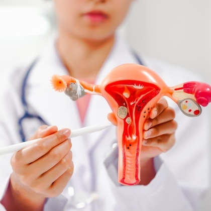 Doctor holding model of a uterus and fallopian tubes