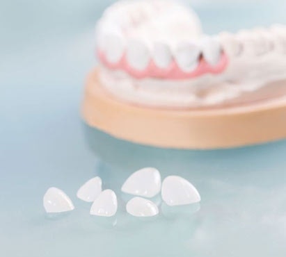 porcelain veneers
