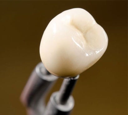 dental crown