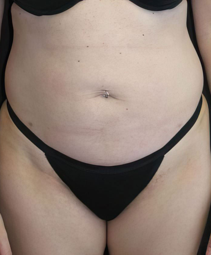 Case 2 before procedure