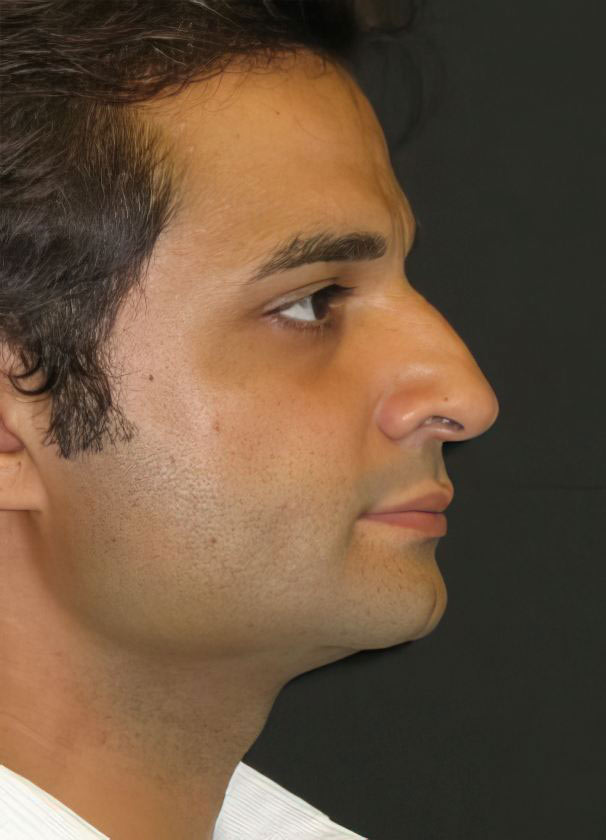 Case 1 before procedure