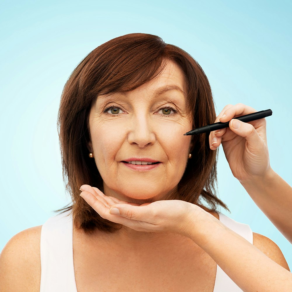 Hand with marker getting ready to make incision lines on female facelift patient's face