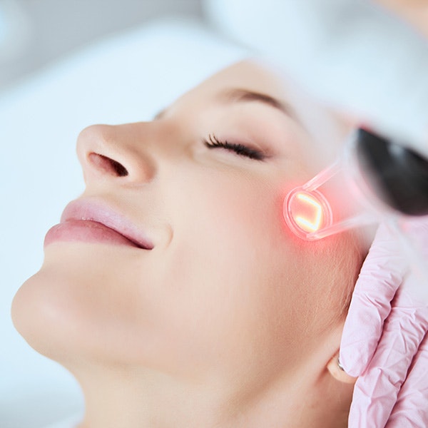 Laser Resurfacing procedure