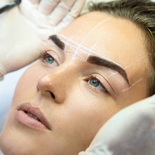 Lines indicating brow lift results